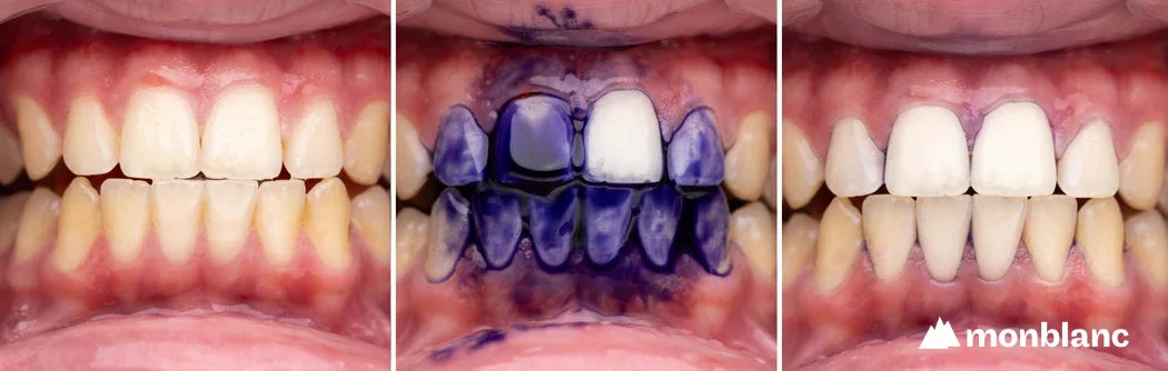 Monblanc Sérum Correcteur de Teinte V34